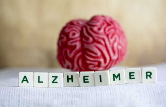 Modell eines Gehirns mit Schriftzug Alzheimer davor.