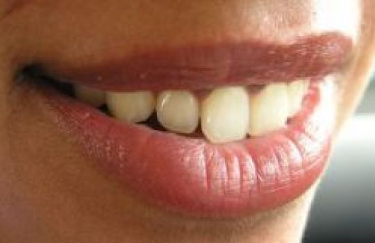 Auch Zähne können einen Entzündungsherd sein.