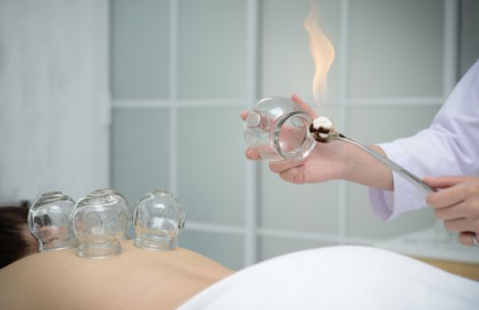 Eine Therapeutin erhitzt Schröpfköpfe mit Feuer und positioniert sie auf dem Rücken der Patientin.