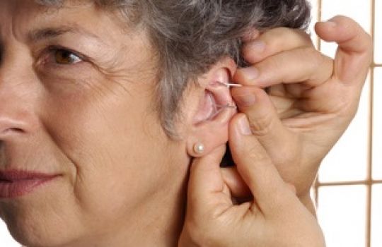 Kleine Ohrnadeln werden den Patienten in die Haut am Ohr eingesetzt.