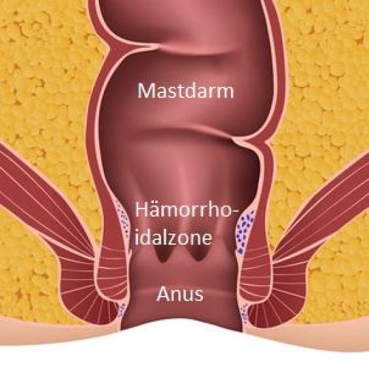 Abbildung der Lage von Hämorrhoiden im Enddarm: Mastdarm, dann Hämorrhoidalzone, dann After.